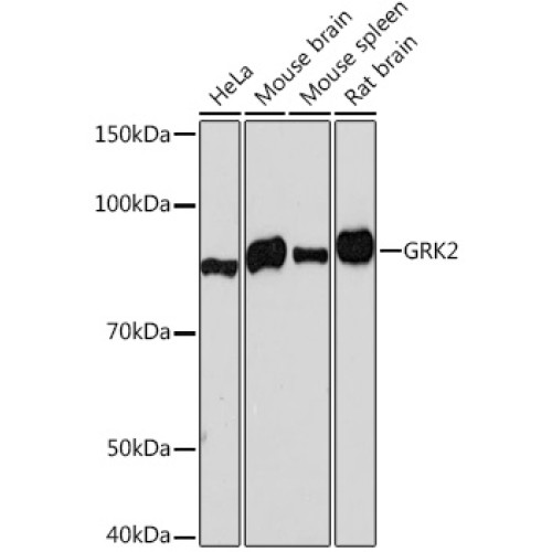 [KO Validated] GRK2 Rabbit mAb