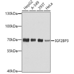 IGF2BP3 Rabbit pAb