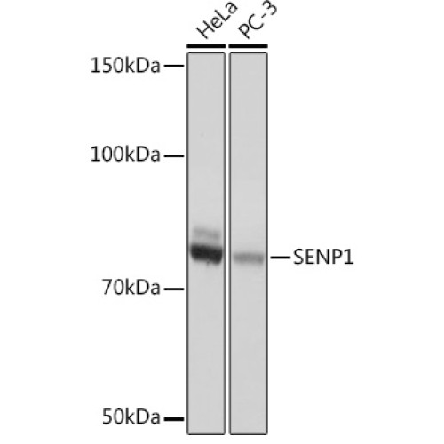 SENP1 Rabbit mAb