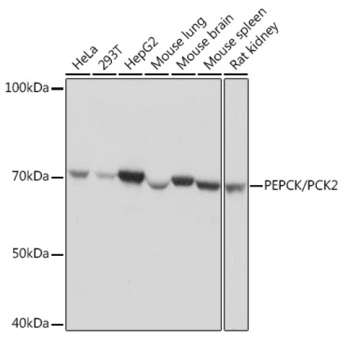 [KO Validated] PEPCK/PCK2 Rabbit mAb