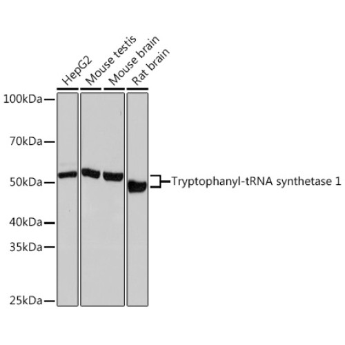 Tryptophanyl-tRNA synthetase 1 Rabbit mAb