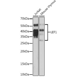 LEF1 Rabbit mAb