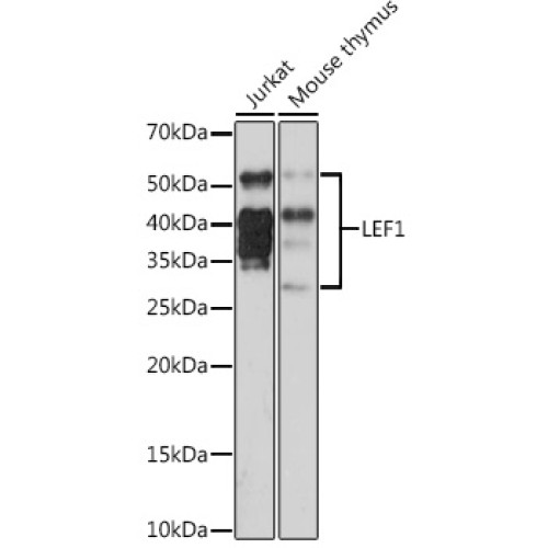 LEF1 Rabbit mAb