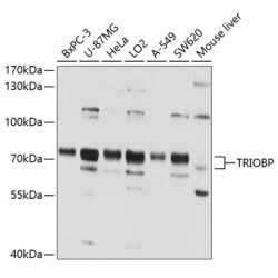 TRIOBP Rabbit pAb