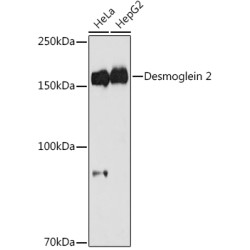Desmoglein 2 Rabbit mAb