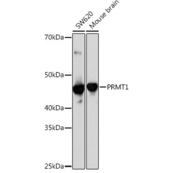 PRMT1 Rabbit mAb