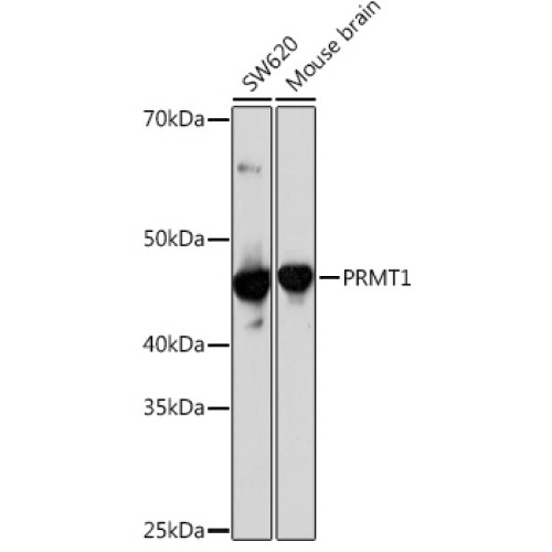 PRMT1 Rabbit mAb
