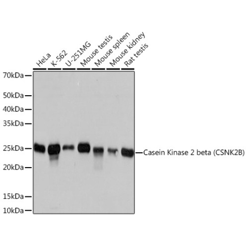 Casein Kinase 2 beta (CSNK2B) Rabbit mAb