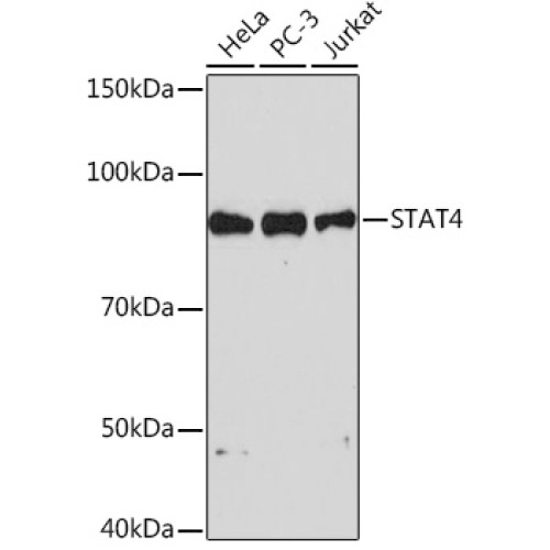 STAT4 Rabbit mAb