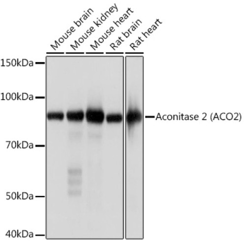 Aconitase 2 (ACO2) Rabbit mAb