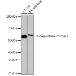 Coagulation Protein C Rabbit mAb