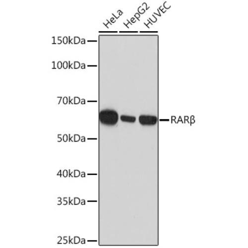RARβ Rabbit mAb