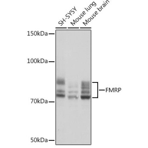 FMRP Rabbit mAb