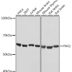 PAK2 Rabbit mAb
