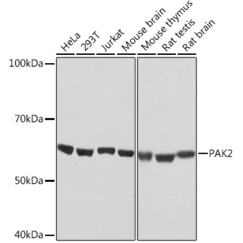 PAK2 Rabbit mAb