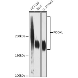 PODXL Rabbit mAb