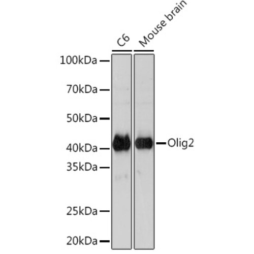 Olig2 Rabbit mAb