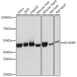 ACADM Rabbit mAb