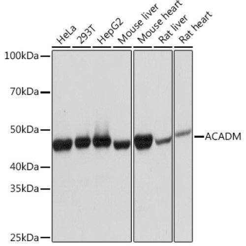 ACADM Rabbit mAb
