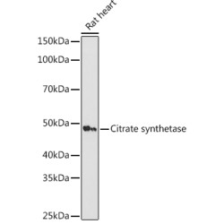 Citrate synthetase Rabbit mAb