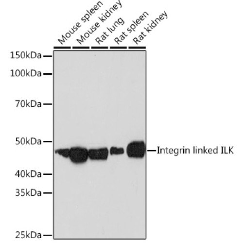 Integrin linked ILK Rabbit mAb
