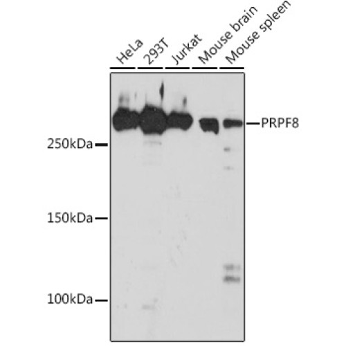 PRPF8 Rabbit mAb