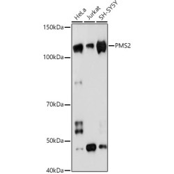 PMS2 Rabbit mAb