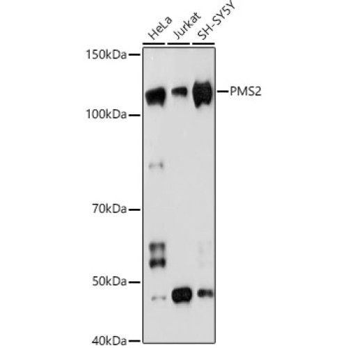 PMS2 Rabbit mAb