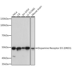Dopamine Receptor D3 (DRD3) Rabbit mAb