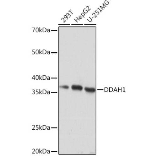 DDAH1 Rabbit mAb