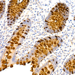 TFF3 Rabbit mAb