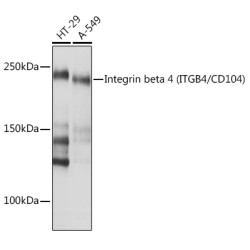 Integrin beta 4 (ITGB4/CD104) Rabbit mAb