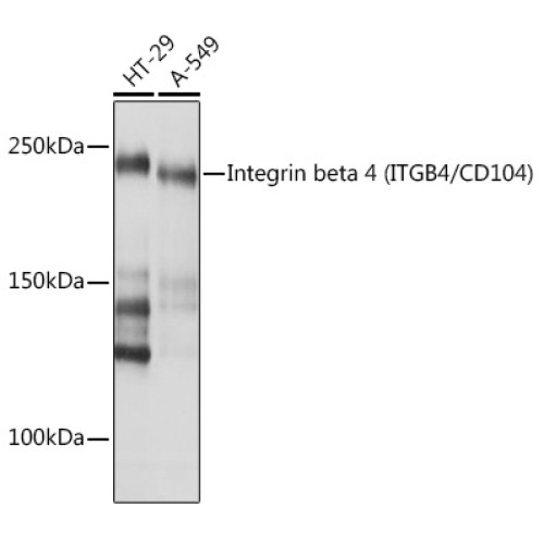 Integrin beta 4 (ITGB4/CD104) Rabbit mAb