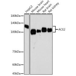 ACE2 Rabbit mAb