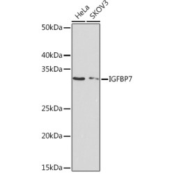IGFBP7 Rabbit mAb
