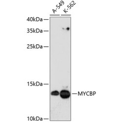 MYCBP Rabbit pAb