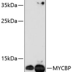 MYCBP Rabbit pAb