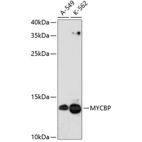 MYCBP Rabbit pAb