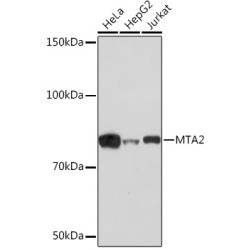 [KO Validated] MTA2 Rabbit mAb