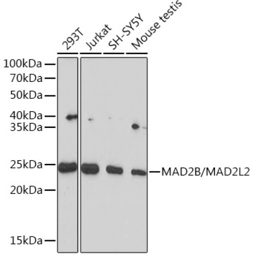 MAD2B/MAD2L2 Rabbit mAb