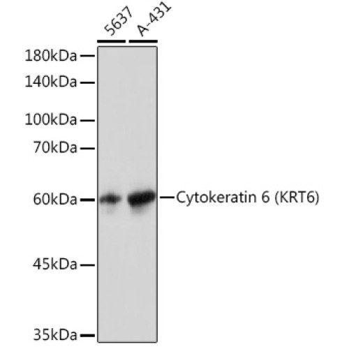 Cytokeratin 6 (KRT6) Rabbit mAb