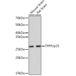 TPPP/p25 Rabbit mAb
