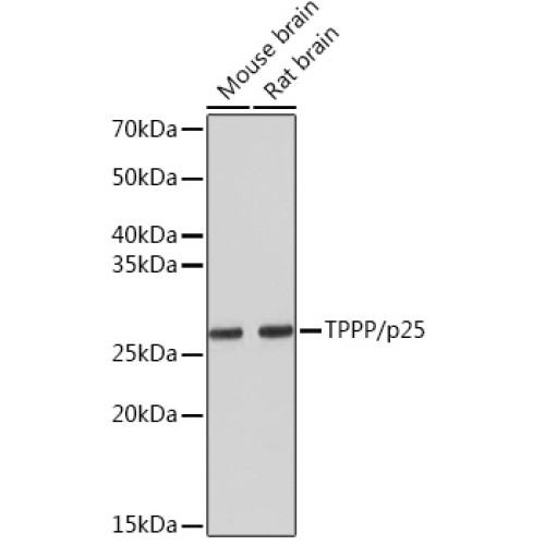 TPPP/p25 Rabbit mAb