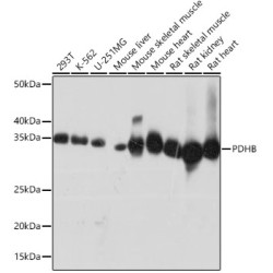PDHB Rabbit mAb