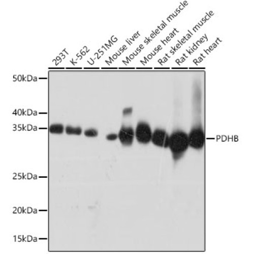 PDHB Rabbit mAb