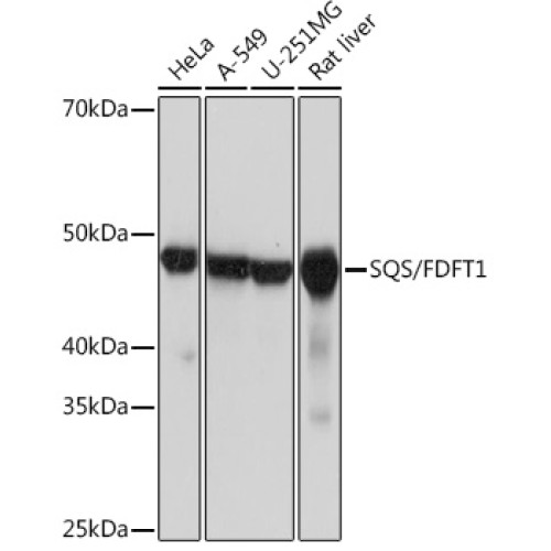 SQS/FDFT1 Rabbit mAb