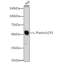 L-Plastin/LCP1 Rabbit mAb