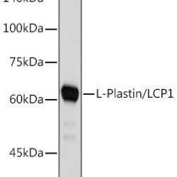 L-Plastin/LCP1 Rabbit mAb