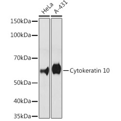 Cytokeratin 10 Rabbit mAb