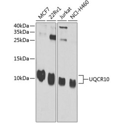 UQCR10 Rabbit pAb